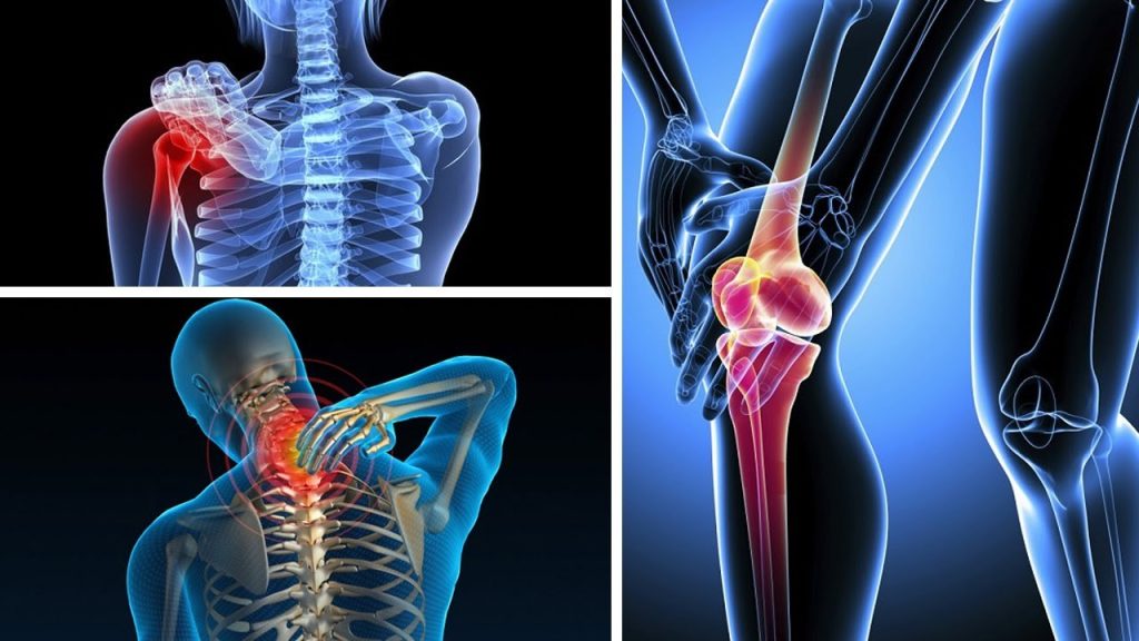 phẫu thuật xương khớp có đi nhật được không